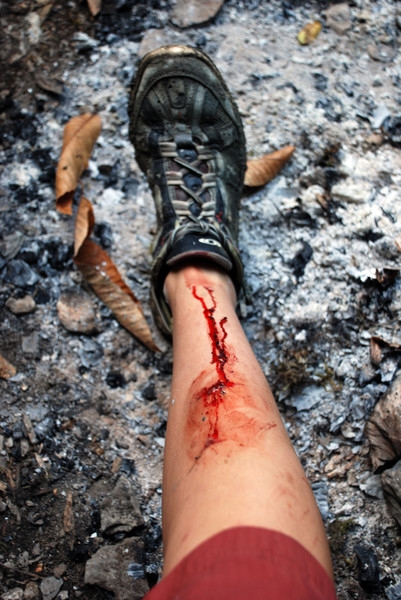 последствия невнимательности