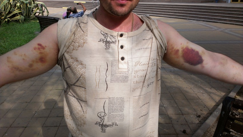 Николай уже на ногах