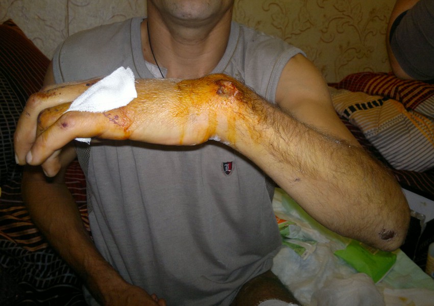 С такой рукой выписывают: само срастется