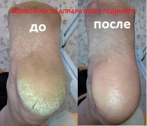 Мастер маникюра и аппаратного педикюра.Ареда